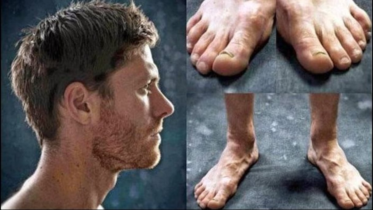 Xabi Alonso