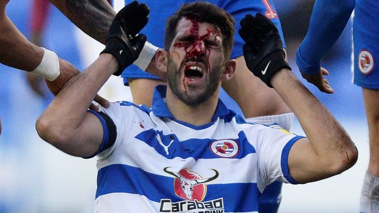 Nelson Oliveira, attaquant de Reading, s'est fait marcher sur le visage en plein match.