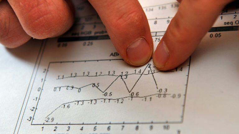 Un exemple de passeport biologique présenté par le laboratoire suisse d'analyse du dopage.