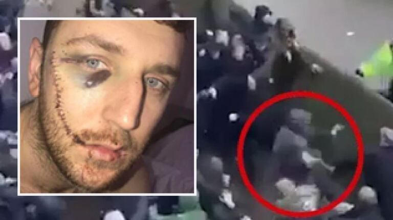 Jay Burns, victime du hooliganisme